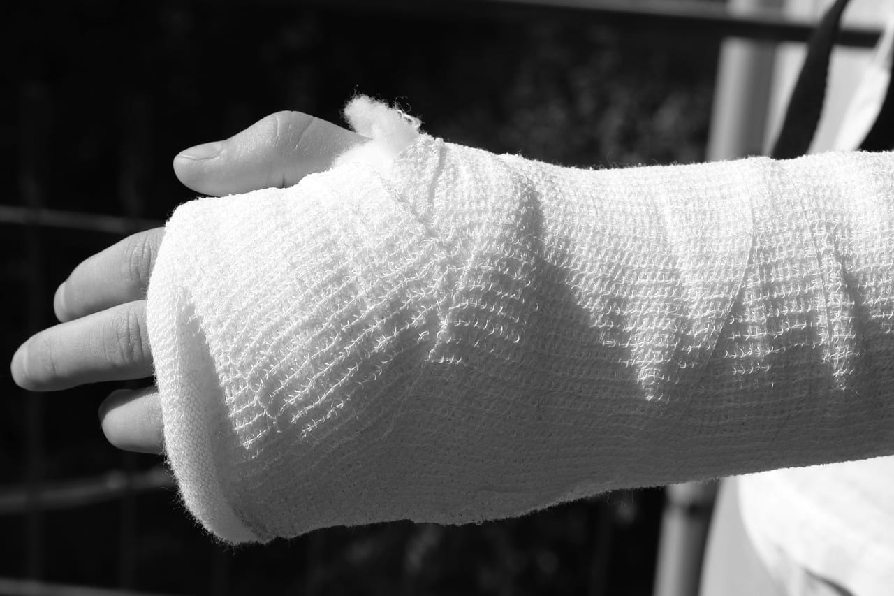 injured person's arm in a cast