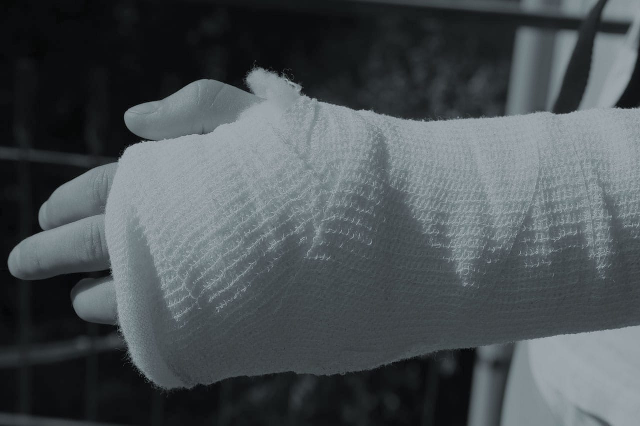 injured person's arm in a cast